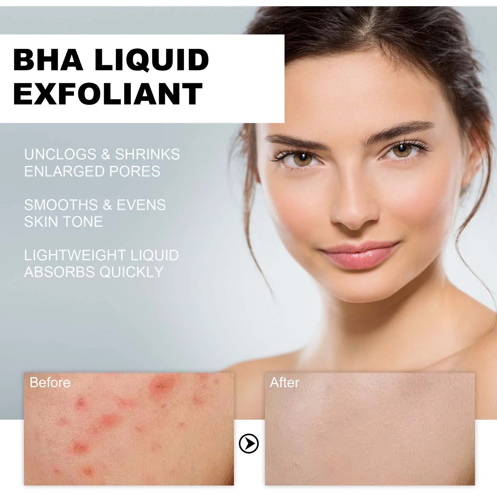 Salicylic acid serum exfoliante piel