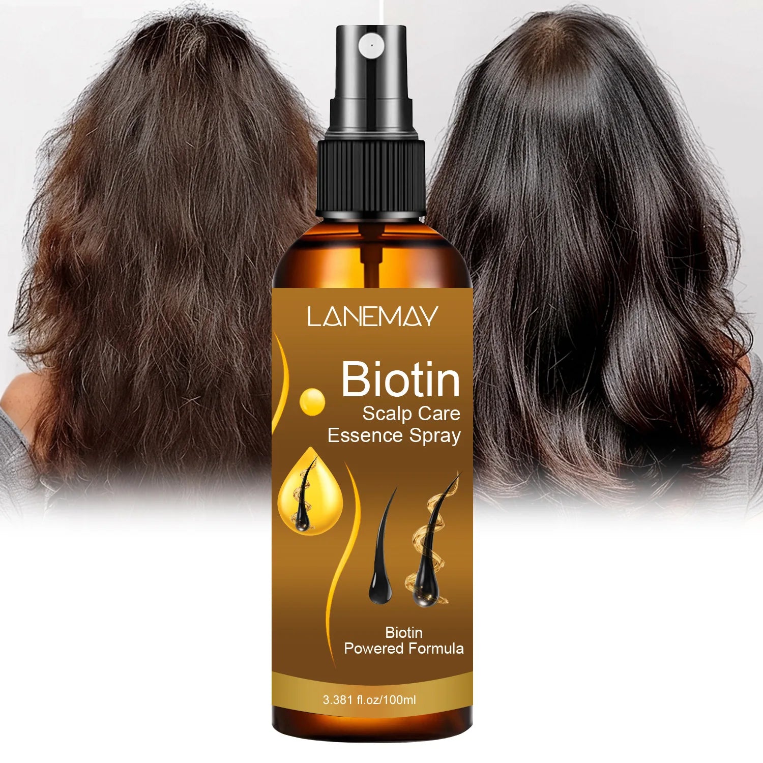 Serum anticaída scalp essence folículos