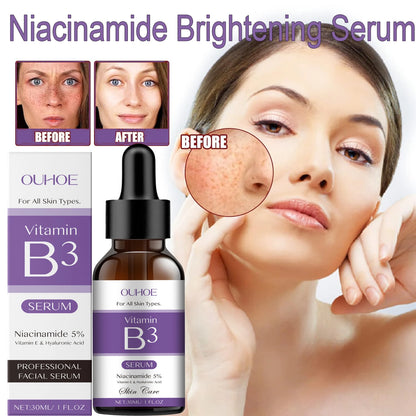 Sérum niacinamida 10% vitamina B3 poros