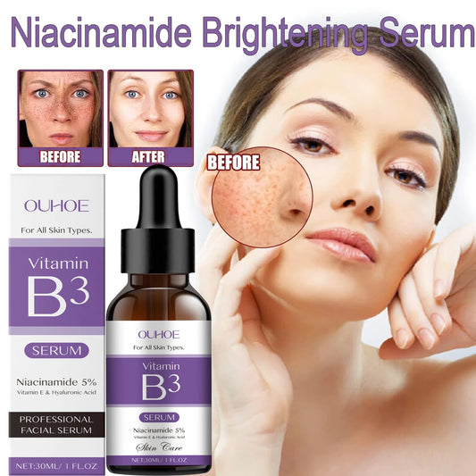 Sérum niacinamida 10% vitamina B3 poros